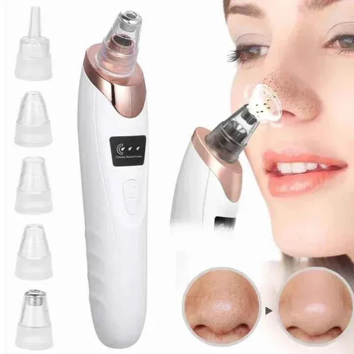 Electric Blackhead Remover – Multifunctional Pore Cleaner for Acne & Skincare | COD in Pakistan - SMARTONLINEMART