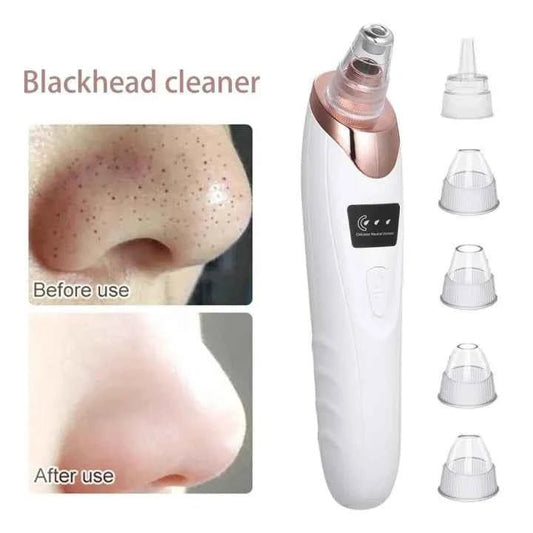 Electric Blackhead Remover – Multifunctional Pore Cleaner for Acne & Skincare | COD in Pakistan - SMARTONLINEMART