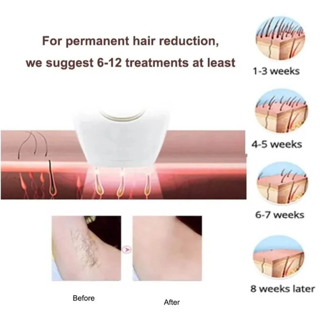 Laser Hair Removal Handset with Razor & Glasses for Women and Men - SMARTONLINEMART